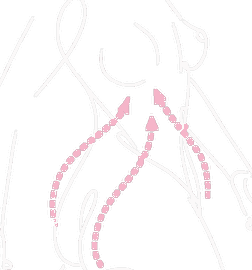 Breast lift with fat grafting